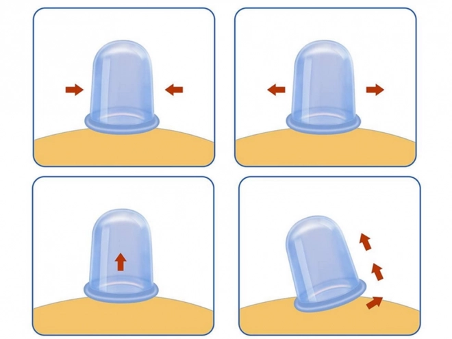 Siliconen massage set van Chinese bubbels