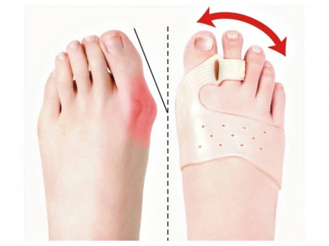 Teenenspreider voor hallux valgus met magneet